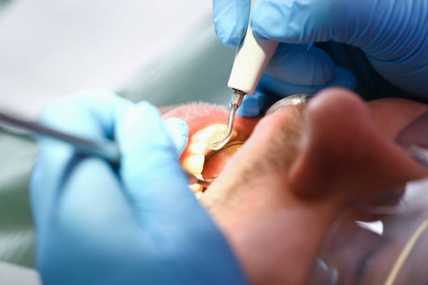 Best Pediatric Emergency Dentist in Ocala Estates, FL